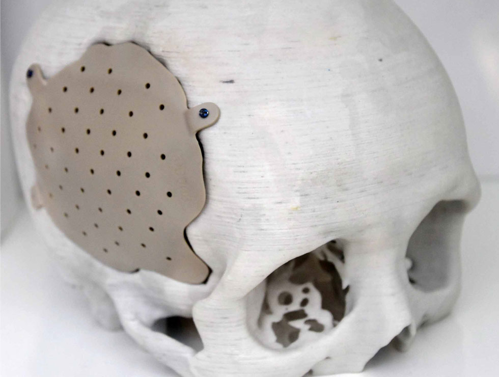 �@������ɫ�ĸ�ˎ��������Ŀ��������3D��ӡ���XĤ��